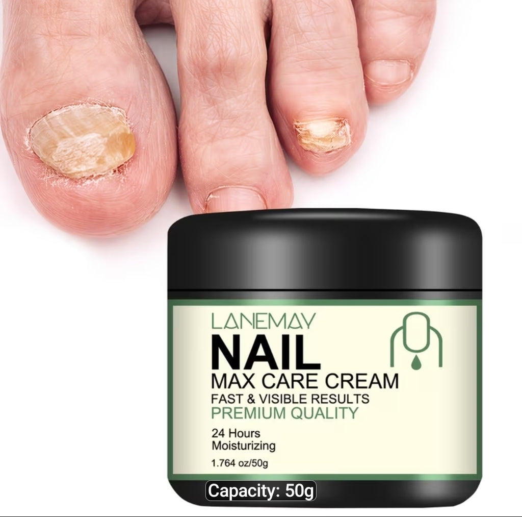 Nail Care Cream for Dry, Brittle Nails, Infused with Bee Venom, Vitamin C & Hyaluronic Acid, 24H Hydration to Support Stronger-Looking Nails, Gentle Formula